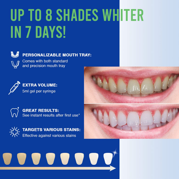 VieBeauti Teeth Whitening Kit - 5X LED Light Tooth Whitener with 35% Carbamide Peroxide, Mouth Trays, Remineralizing Gel and Tray Case - Built-in 10 Minute Timer Restores Your White Smile