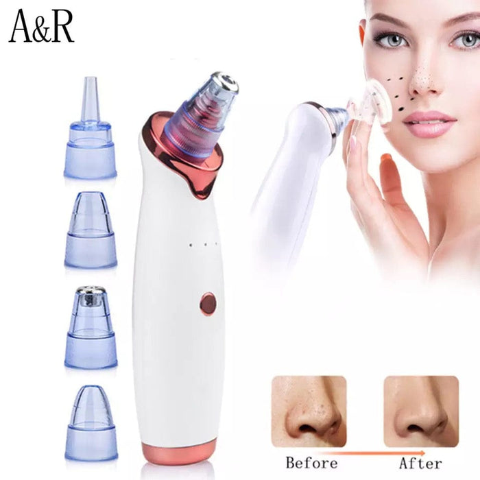 Electric Cleaner Face Blackhead Remover