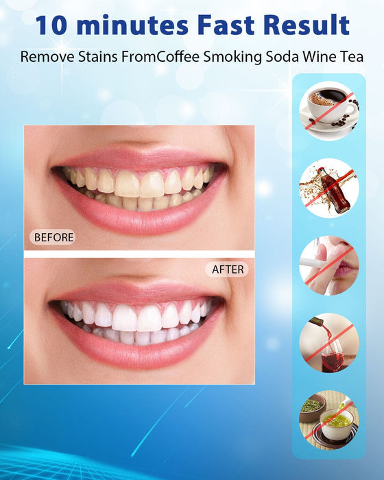 Teeth Whitening Kit at Home Light Tray FDA Gel Coffee Stain Removal
